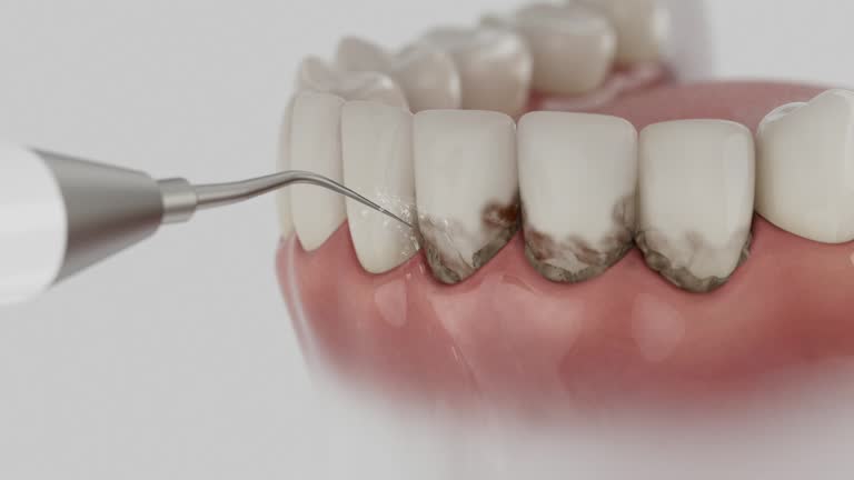 Reliable Dental Implants contractor in Junction City, KS by Smile Center Dentistry